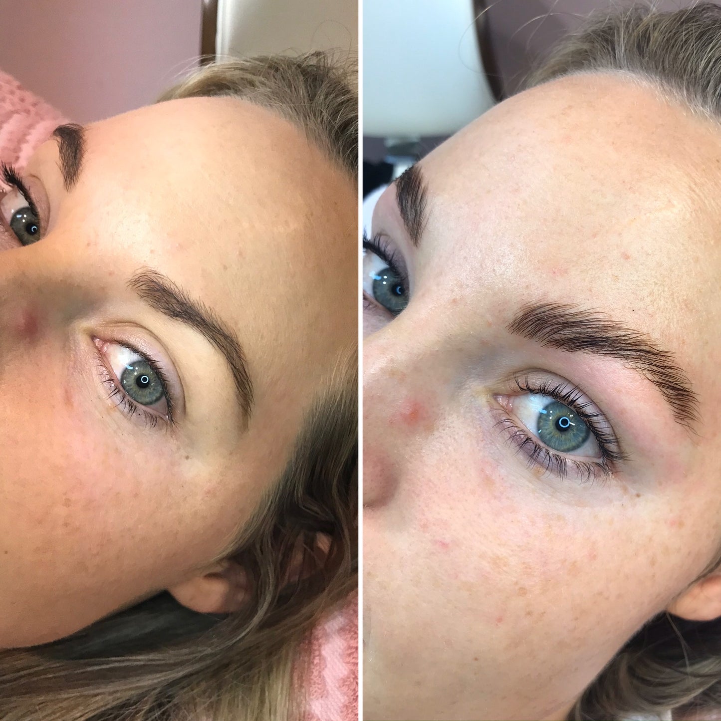 Lash Lift Shields: 5 Pack